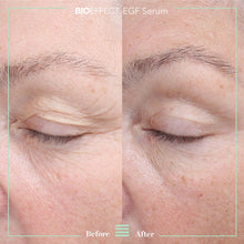 Afbeelding in Gallery-weergave laden, EGF SERUM 15 ml + 5 ml

